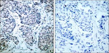 Immunohistochemistry (Formalin/PFA-fixed paraffin-embedded sections) - Anti-MEK4/MKK4 (phospho T261) antibody (AB131351), expandable thumbnail