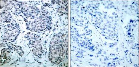 Immunohistochemistry (Formalin/PFA-fixed paraffin-embedded sections) - Anti-MEK4/MKK4 (phospho T261) antibody (AB131351)