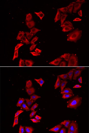 Immunocytochemistry/ Immunofluorescence - Anti-MEK5 antibody (AB210748)