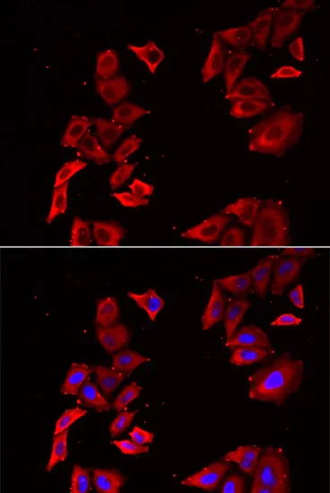 Immunocytochemistry/ Immunofluorescence - Anti-MEK5 antibody (AB210748)