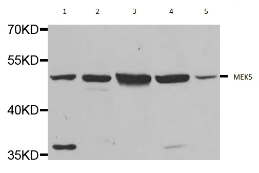 Western blot - Anti-MEK5 antibody (AB210748)