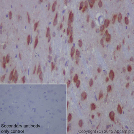 Immunohistochemistry (Formalin/PFA-fixed paraffin-embedded sections) - Anti-MEKK2 antibody [EP626Y] (AB33918)