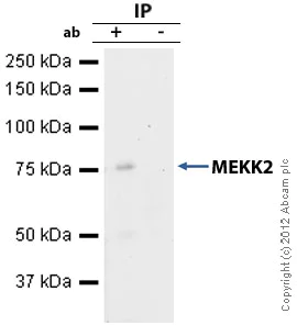 Immunoprecipitation - Anti-MEKK2 antibody [EP626Y] (AB33918)