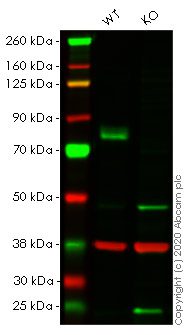 Western blot - Anti-MEKK2 antibody [EP626Y] (AB33918)