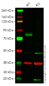Western blot - Anti-MEKK2 antibody [EP626Y] (AB33918)