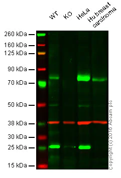 Western blot - Anti-MEKK2 antibody [EP626Y] - BSA and Azide free (AB240926)