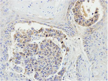 Immunohistochemistry (Formalin/PFA-fixed paraffin-embedded sections) - Anti-MEKK3 antibody (AB154362)