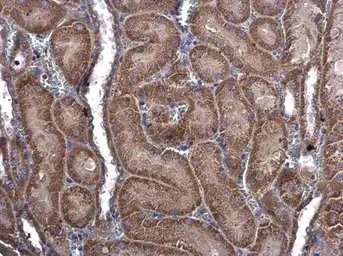 Immunohistochemistry (Formalin/PFA-fixed paraffin-embedded sections) - Anti-MEKK3 antibody (AB154362)