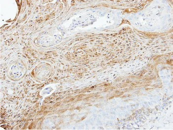 Immunohistochemistry (Formalin/PFA-fixed paraffin-embedded sections) - Anti-MEKK3 antibody (AB154362)