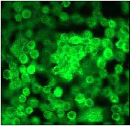 Immunocytochemistry/ Immunofluorescence - Anti-MEKK3 antibody [ep600y] (AB40756)