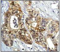 Immunohistochemistry (Formalin/PFA-fixed paraffin-embedded sections) - Anti-MEKK3 antibody [ep600y] - BSA and Azide free (AB239826)