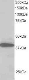 Western blot - Anti-Mel18 antibody (AB5267)