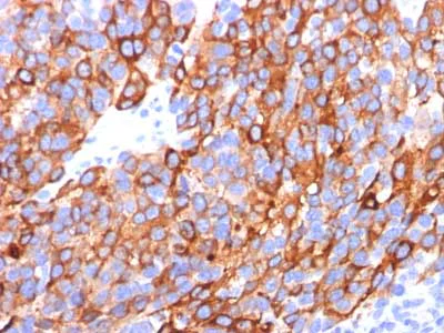 Immunohistochemistry (Formalin/PFA-fixed paraffin-embedded sections) - Anti-MelanA antibody [A103 + M2-7C10 + M2-9E3] - BSA and Azide free (AB212366)