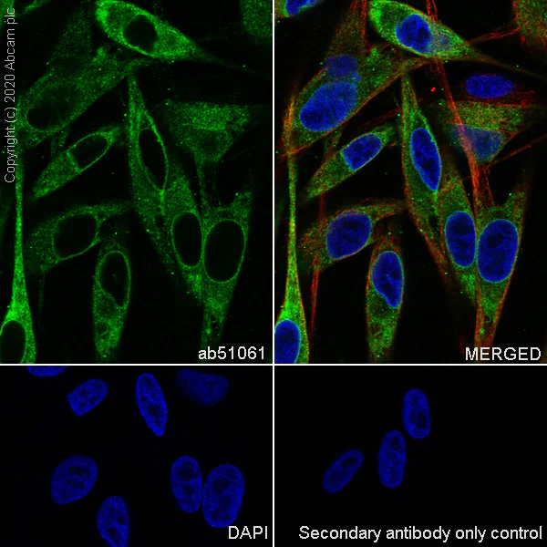 Immunocytochemistry/ Immunofluorescence - Anti-MelanA antibody [EP1422Y] - BSA and Azide free (AB271839)