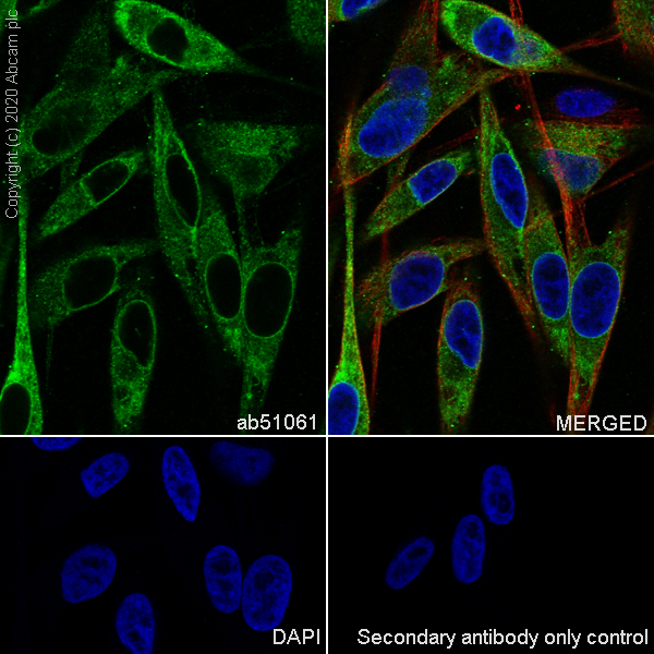 Immunocytochemistry/ Immunofluorescence - Anti-MelanA antibody [EP1422Y] - Low endotoxin, Azide free (AB170090), expandable thumbnail