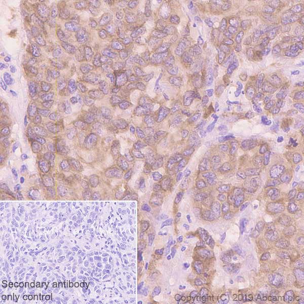 Immunohistochemistry (Formalin/PFA-fixed paraffin-embedded sections) - Anti-MelanA antibody [EP1422Y] - Low endotoxin, Azide free (AB170090), expandable thumbnail