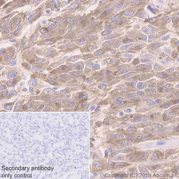 Immunohistochemistry (Formalin/PFA-fixed paraffin-embedded sections) - Anti-MelanA antibody [EPR20380] (AB210546)