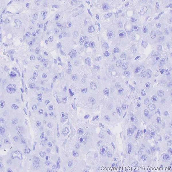 Immunohistochemistry (Formalin/PFA-fixed paraffin-embedded sections) - Anti-MelanA antibody [EPR20380] (AB210546)