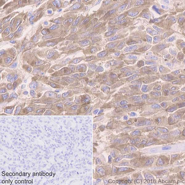 Immunohistochemistry (Formalin/PFA-fixed paraffin-embedded sections) - Anti-MelanA antibody [EPR20380] - BSA and Azide free (AB222483), expandable thumbnail