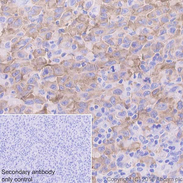 Immunohistochemistry (Formalin/PFA-fixed paraffin-embedded sections) - Anti-MelanA antibody [EPR20380] - BSA and Azide free (AB222483), expandable thumbnail