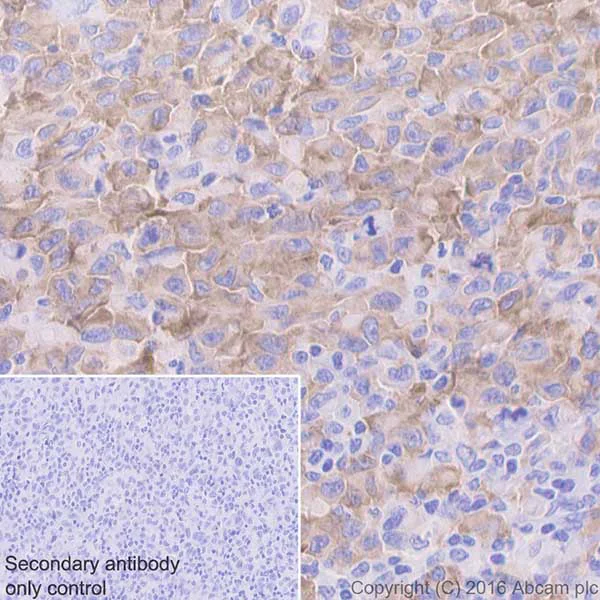 Immunohistochemistry (Formalin/PFA-fixed paraffin-embedded sections) - Anti-MelanA antibody [EPR20380] - BSA and Azide free (AB222483)