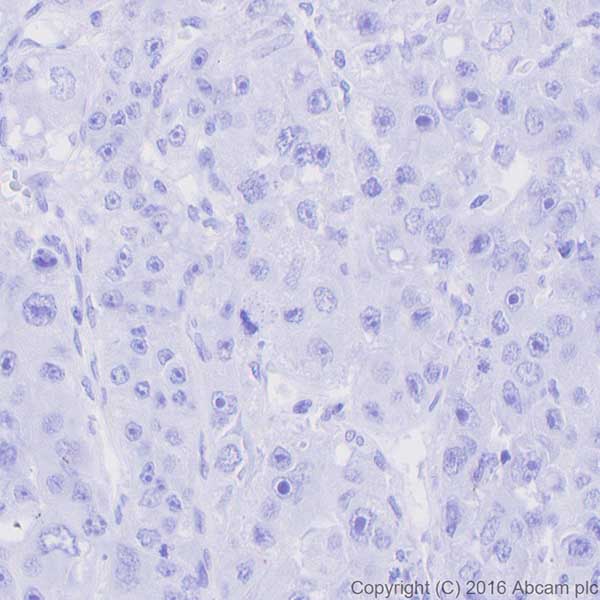 Immunohistochemistry (Formalin/PFA-fixed paraffin-embedded sections) - Anti-MelanA antibody [EPR20380] - BSA and Azide free (ab222483), expandable thumbnail