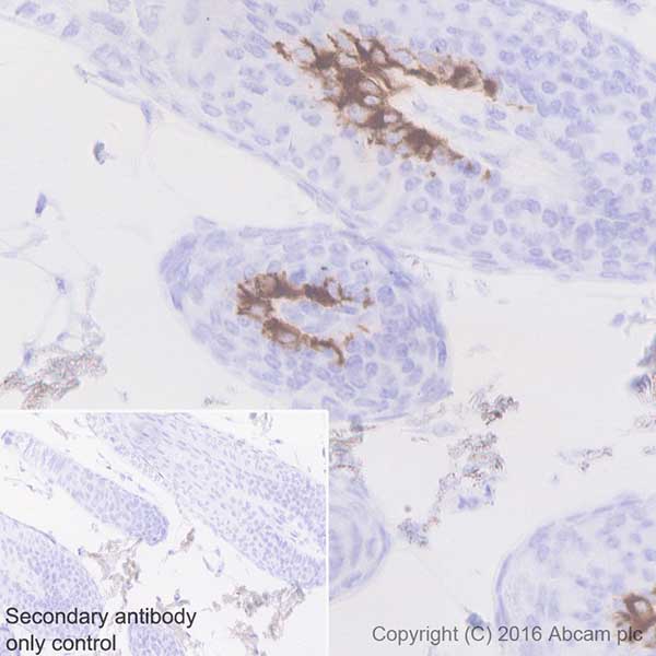 Immunohistochemistry (Formalin/PFA-fixed paraffin-embedded sections) - Anti-MelanA antibody [EPR20380] - BSA and Azide free (AB222483), expandable thumbnail