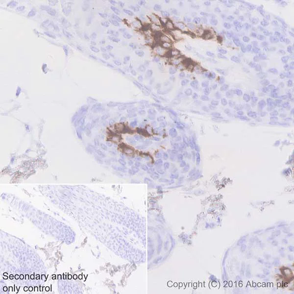 Immunohistochemistry (Formalin/PFA-fixed paraffin-embedded sections) - Anti-MelanA antibody [EPR20380] - BSA and Azide free (AB222483)