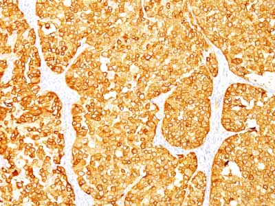 Immunohistochemistry (Formalin/PFA-fixed paraffin-embedded sections) - Anti-MelanA antibody [M2-7C10 + M2-9E3] - BSA and Azide free (AB212367), expandable thumbnail