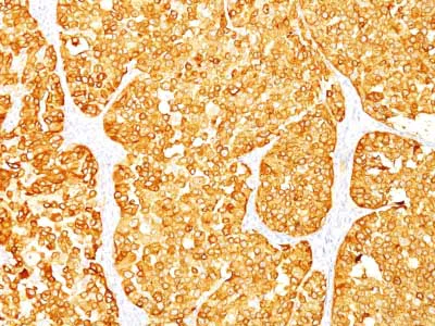 Immunohistochemistry (Formalin/PFA-fixed paraffin-embedded sections) - Anti-MelanA antibody [M2-7C10 + M2-9E3] - BSA and Azide free (AB212367)