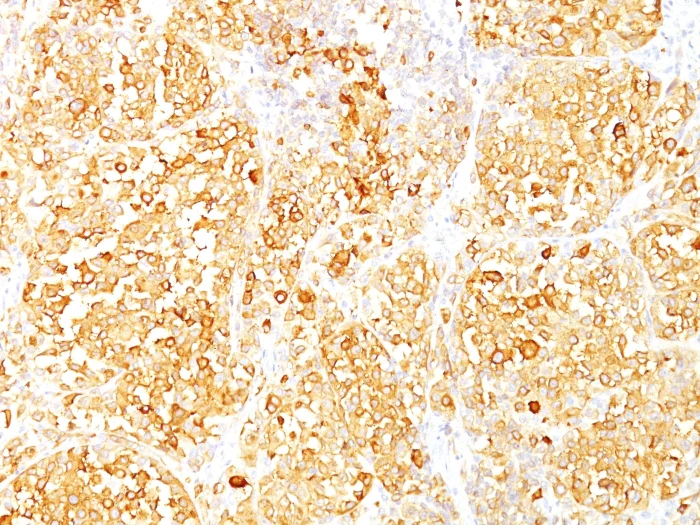 Immunohistochemistry (Formalin/PFA-fixed paraffin-embedded sections) - Anti-MelanA antibody [M2-9E3] (AB187369)