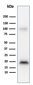 Western blot - Anti-MelanA antibody [M2-9E3] (AB187369), expandable thumbnail