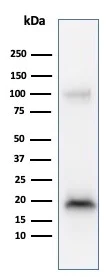 Western blot - Anti-MelanA antibody [M2-9E3] (AB187369)