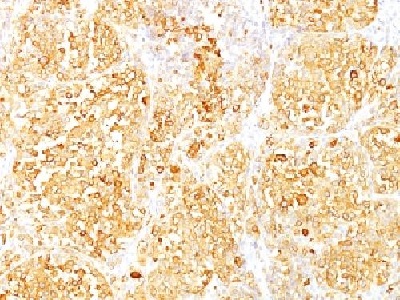 Immunohistochemistry (Formalin/PFA-fixed paraffin-embedded sections) - Anti-MelanA antibody [M2-9E3] - BSA and Azide free (AB212362), expandable thumbnail