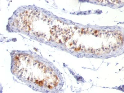 Immunohistochemistry (Formalin/PFA-fixed paraffin-embedded sections) - Anti-MelanA antibody [MLANA/788] (AB215756)
