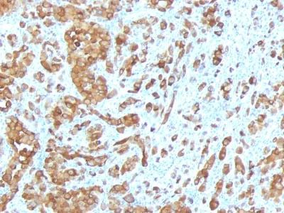 Immunohistochemistry (Formalin/PFA-fixed paraffin-embedded sections) - Anti-MelanA antibody [MLANA/788] (AB215756)