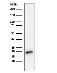 Western blot - Anti-MelanA antibody [MLANA/788] (AB215756), expandable thumbnail