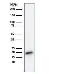 Western blot - Anti-MelanA antibody [MLANA/788] (AB215756)