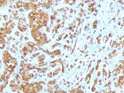 Immunohistochemistry (Formalin/PFA-fixed paraffin-embedded sections) - Anti-MelanA antibody [MLANA/788] - BSA and Azide free (AB212368), expandable thumbnail