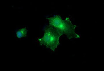 Immunocytochemistry/ Immunofluorescence - Anti-MelanA antibody [OTI3E2] (AB140503), expandable thumbnail