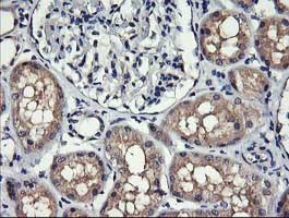 Immunohistochemistry (Formalin/PFA-fixed paraffin-embedded sections) - Anti-MelanA antibody [OTI3E2] (AB140503), expandable thumbnail