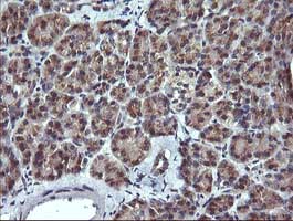 Immunohistochemistry (Formalin/PFA-fixed paraffin-embedded sections) - Anti-MelanA antibody [OTI3E2] (AB140503), expandable thumbnail