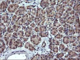 Immunohistochemistry (Formalin/PFA-fixed paraffin-embedded sections) - Anti-MelanA antibody [OTI3E2] (AB140503)