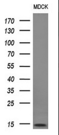 Western blot - Anti-MelanA antibody [OTI3E2] (AB140503), expandable thumbnail