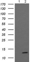 Western blot - Anti-MelanA antibody [OTI3E2] (AB140503), expandable thumbnail