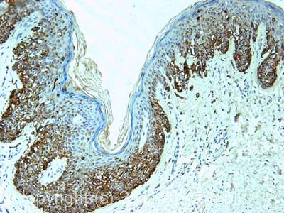 Immunohistochemistry (Formalin/PFA-fixed paraffin-embedded sections) - Anti-Melanoma antibody [PNL2] (AB12502)
