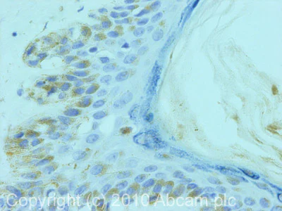 Immunohistochemistry (Formalin/PFA-fixed paraffin-embedded sections) - Anti-Melanoma Associated Antigen 100+ / 7 kDa antibody [NKI/beteb] (AB34165)