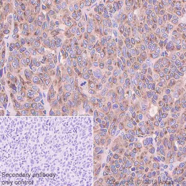Immunohistochemistry (Formalin/PFA-fixed paraffin-embedded sections) - Anti-Melanoma gp100 antibody [EP4863(2)] - Low endotoxin, Azide free (AB193201)