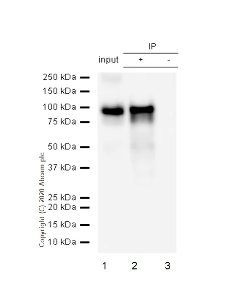 Immunoprecipitation - Anti-Melanoma gp100 antibody [EP4863(2)] - Low endotoxin, Azide free (AB193201)