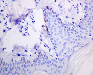 Immunohistochemistry (Formalin/PFA-fixed paraffin-embedded sections) - Anti-Melanoma gp100 antibody [EPR4864] (ab137062), expandable thumbnail